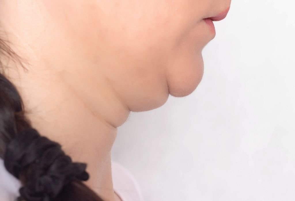 harmonização orofacial