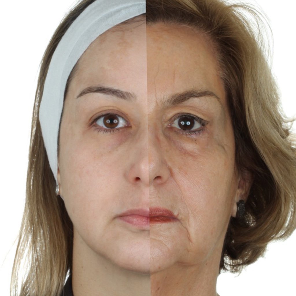 harmonização orofacial