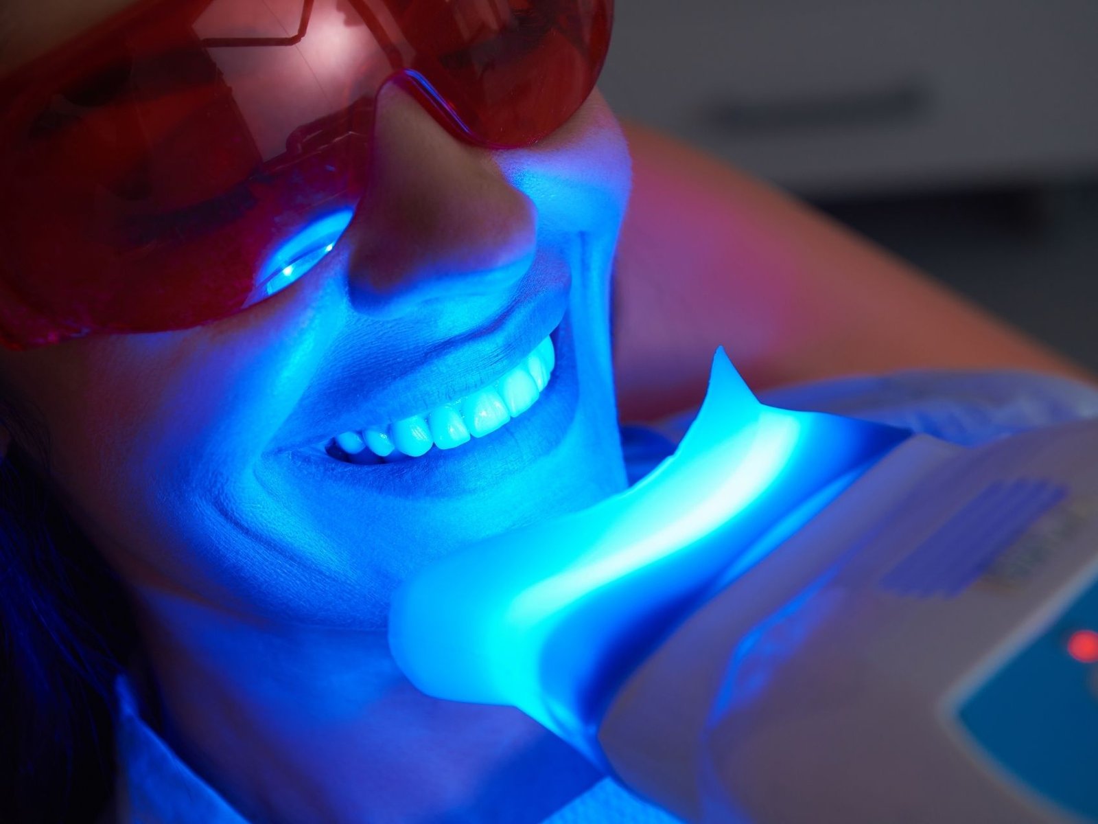 branqueamento dentário